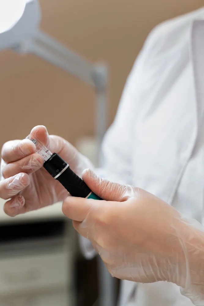 Clinician preparing a sterile microneedling pen before treatment at All Things Beauty, Baldivis
